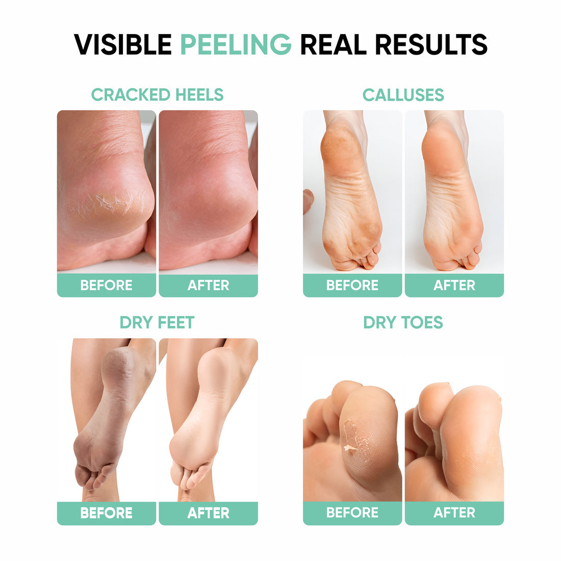 The Pure Glow™ Exfoliating Foot Peel